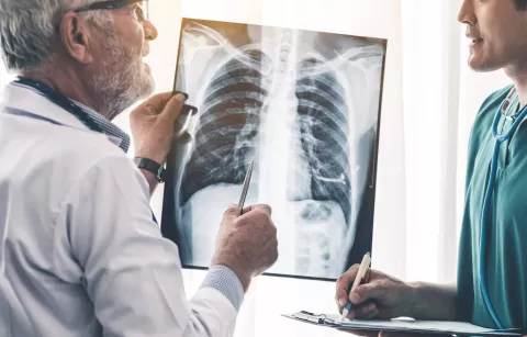 Pemetrexed Poses High Toxicity Risk in NSCLC Patients with Moderate Renal Impairment